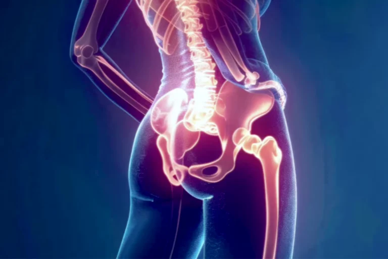 Persona con dolor en la zona lumbar aplicando calor y realizando estiramientos como remedios naturales para aliviar el dolor lumbar.