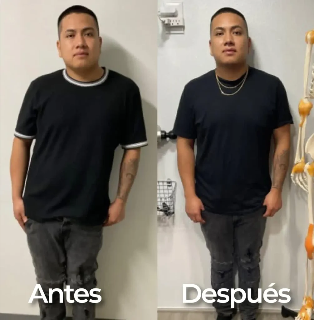 antes y despues testimonio